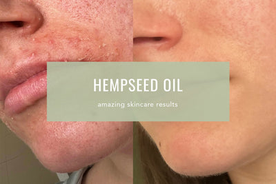 Hempseed Oil Is Good For Your Skin